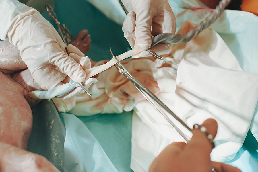 A doctor holds the umbilical cord of a newborn child with clips and the father cuts it with scissors in the maternity home, The birth of the baby.The concept of health care.