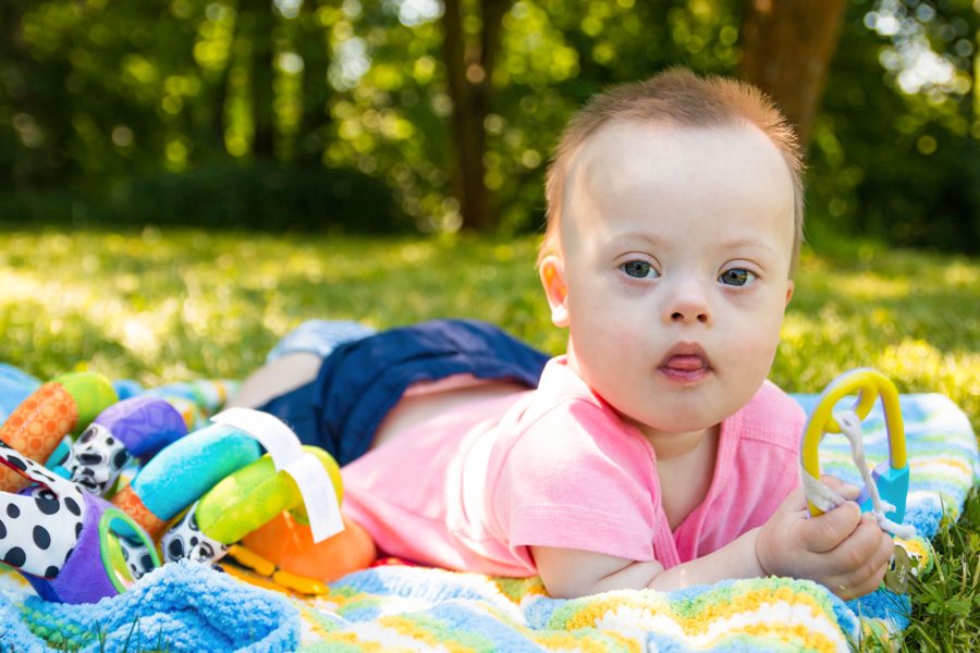 Portrait of Cute baby boy with Down syndrome lying on blanket in summer day on nature with toys