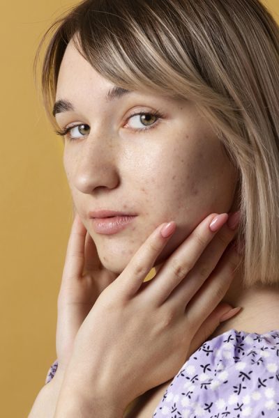 woman-posing-with-yellow-background